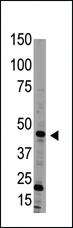 Anti-BMP15 Rabbit Polyclonal Antibody