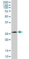 Anti-PRDX4 Mouse Polyclonal Antibody