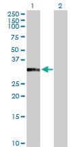 Anti-ANXA10 Rabbit Polyclonal Antibody