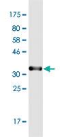 Anti-CCL2 Mouse Monoclonal Antibody [clone: 3H7]