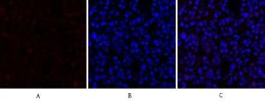 Immunofluorescence analysis of rat lung tissue using Anti-p70 S6 Kinase Antibody (red) at 1:200 (4°C overnight). Cy3 labelled secondary antibody was used at 1:300 (RT 50min). Panel A: Target. Panel B: DAPI. Panel C: Merge