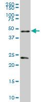 Anti-RXRA Mouse Monoclonal Antibody [clone: 4D6]