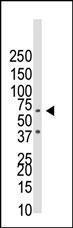 Anti-BMPR1B Rabbit Polyclonal Antibody (Biotin)