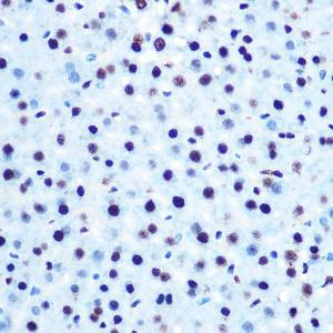 Immunohistochemistry analysis of paraffin-embedded mouse liver using Anti-IRS1 (phospho Ser612) Antibody (A11031) at a dilution of 1:100 (40X lens). Perform microwave antigen retrieval with 10 mM Tris/EDTA buffer pH 9.0 before commencing with IHC staining protocol