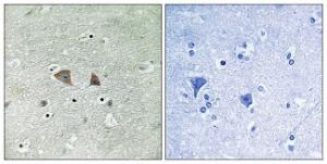 Immunohistochemical analysis of paraffin-embedded human brain tissue using Anti-p70 S6 Kinase Antibody. The right hand panel represents a negative control, where the antibody was pre-incubated with the immunising peptide.