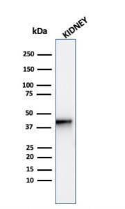 Western blot analysis of human kidney tissue lysate using Anti-AMACR Antibody [AMACR/4572R]