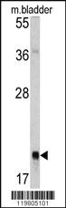 Anti-RAB13 Rabbit Polyclonal Antibody