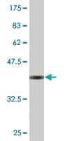 Anti-MED22 Mouse Monoclonal Antibody [clone: 3A9]