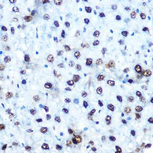 Immunohistochemistry analysis of paraffin-embedded rat liver using Anti-IRS1 (phospho Ser612) Antibody (A11031) at a dilution of 1:100 (40X lens). Perform microwave antigen retrieval with 10 mM Tris/EDTA buffer pH 9.0 before commencing with IHC staining protocol