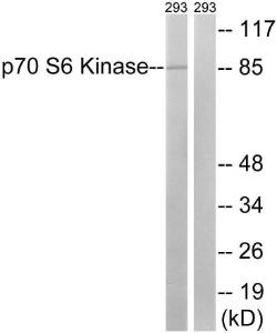 Western blot analysis of lysates from 293 cells using Anti-p70 S6 Kinase Antibody. The right hand lane represents a negative control, where the antibody is blocked by the immunising peptide.