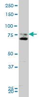 Anti-SMO Mouse Monoclonal Antibody [clone: 1D9]