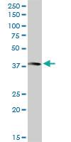 Anti-ANXA10 Rabbit Polyclonal Antibody