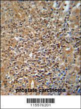 Anti-PHB2 Rabbit Polyclonal Antibody