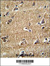 Anti-RAB13 Rabbit Polyclonal Antibody