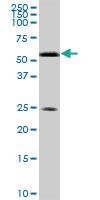 Anti-RXRA Mouse Monoclonal Antibody [clone: 1D7]