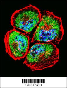 Anti-MMP3 Rabbit Polyclonal Antibody (AP (Alkaline Phosphatase))