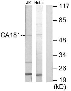 Western blot analysis of lysates from Jurkat and HeLa cells using Anti-CA181 Antibody. The right hand lane represents a negative control, where the Antibody is blocked by the immunising peptide