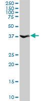 Anti-ANXA10 Rabbit Polyclonal Antibody