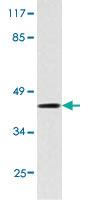 Anti-IKBKG Rabbit Polyclonal Antibody