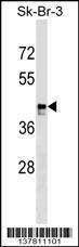 Anti-MARCH9 Rabbit Polyclonal Antibody (HRP (Horseradish Peroxidase))