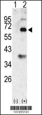 Anti-BMP3 Rabbit Polyclonal Antibody