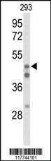 Anti-HNF4A Rabbit Polyclonal Antibody