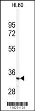 Anti-PRKRA Rabbit Polyclonal Antibody