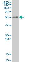 Anti-RXRA Mouse Monoclonal Antibody [clone: 3A5]