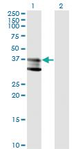 Anti-SMPD1 Mouse Monoclonal Antibody [clone: 4H2]