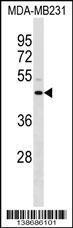 Anti-ANXA8L1 Rabbit Polyclonal Antibody (Biotin)