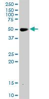 Anti-RXRA Mouse Monoclonal Antibody [clone: 3A5]