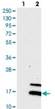 Anti-RNASE7 Rabbit Polyclonal Antibody