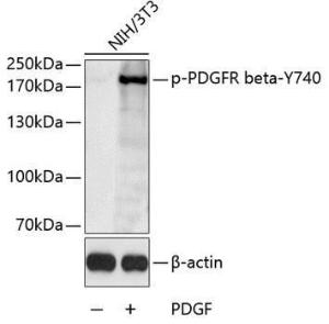 Western blot analysis of extracts of NIH/3T3 cells, using Anti-PDGFR beta (phospho Tyr740) Antibody (A11034)