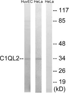 Antibody anti-C1QL2 100 µg