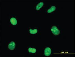 Anti-HMGB1 Mouse Monoclonal Antibody [clone: 1D10]