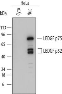 Anti-LEDGF Mouse Monoclonal Antibody [clone: 762815]