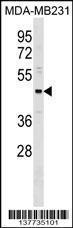 Anti-ONECUT3 Rabbit Polyclonal Antibody (AP (Alkaline Phosphatase))