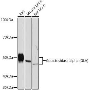 Western blot analysis of extracts of various cell lines, using Anti-Galactosidase alpha Antibody [ARC1213] (A305895) at 1:1,000 dilution