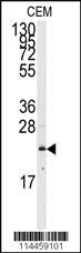 Anti-CDKN2B Rabbit Polyclonal Antibody