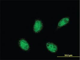 Anti-RXRA Mouse Monoclonal Antibody [clone: 3A5]