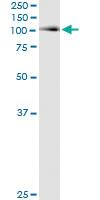 Anti-ACO1 Antibody Pair