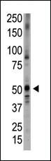 Anti-BMP5 Rabbit Polyclonal Antibody