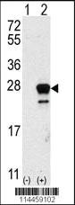 Anti-CDKN2B Rabbit Polyclonal Antibody