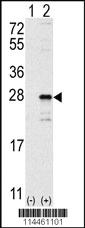 Anti-NRAS Rabbit Polyclonal Antibody