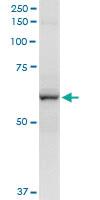 Anti-CYP2A13 Polyclonal Antibody Pair