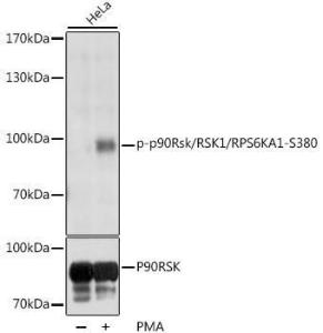 Antibody anti-P90RSK phospho S380 100 µl