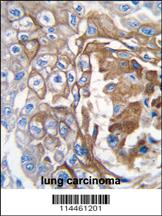 Anti-NRAS Rabbit Polyclonal Antibody