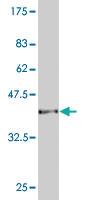 Anti-CAMK2D Mouse Monoclonal Antibody [clone: 1A8]