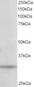 EB06319 staining (1µg/ml) of 293 lysate (RIPA buffer, 35µg total protein per lane).  Primary incubated for 1 hour.  Detected by western blot using chemiluminescence.