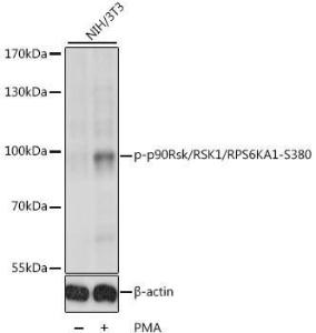 Antibody anti-P90RSK phospho S380 100 µl